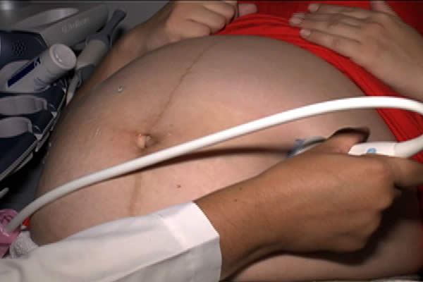 Preeclampsia, la principal causa de muerte materna y prenatal