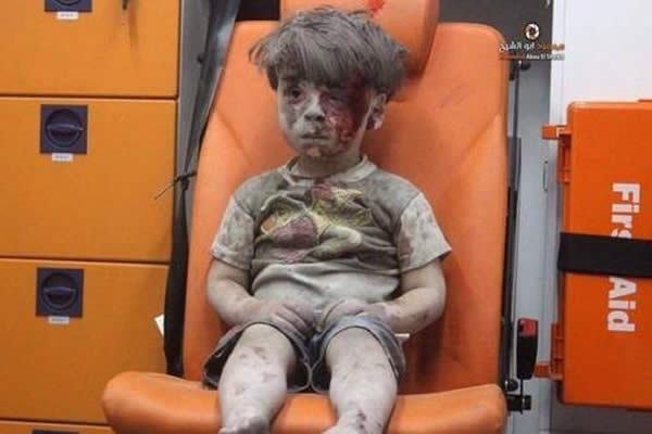 Por qué las imágenes de este niño sirio nos preocupan más que las de cualquier adulto en la misma guerra