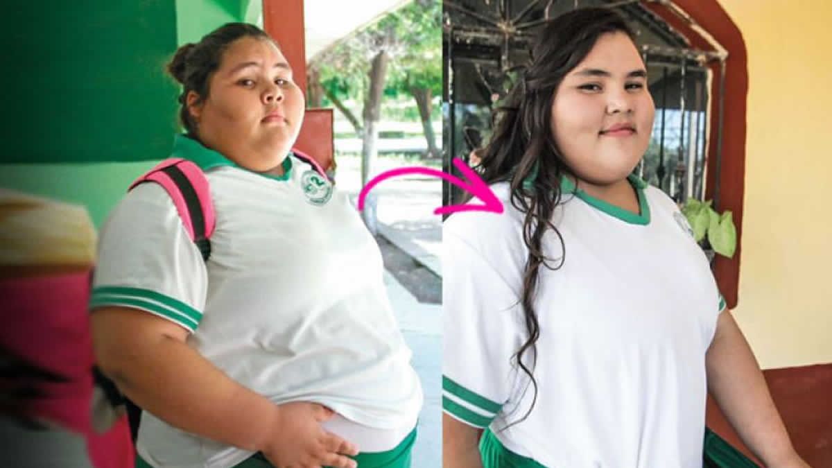 La adolescente más gorda del mundo bajo de peso 