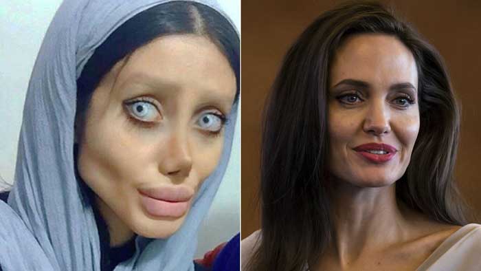 Joven se somete a 50 cirugías para parecerse a Angelina Jolie