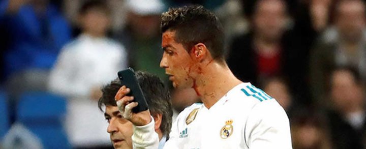 Cristiano Ronaldo abandona el terreno de juego con el rostro ensangrentado 