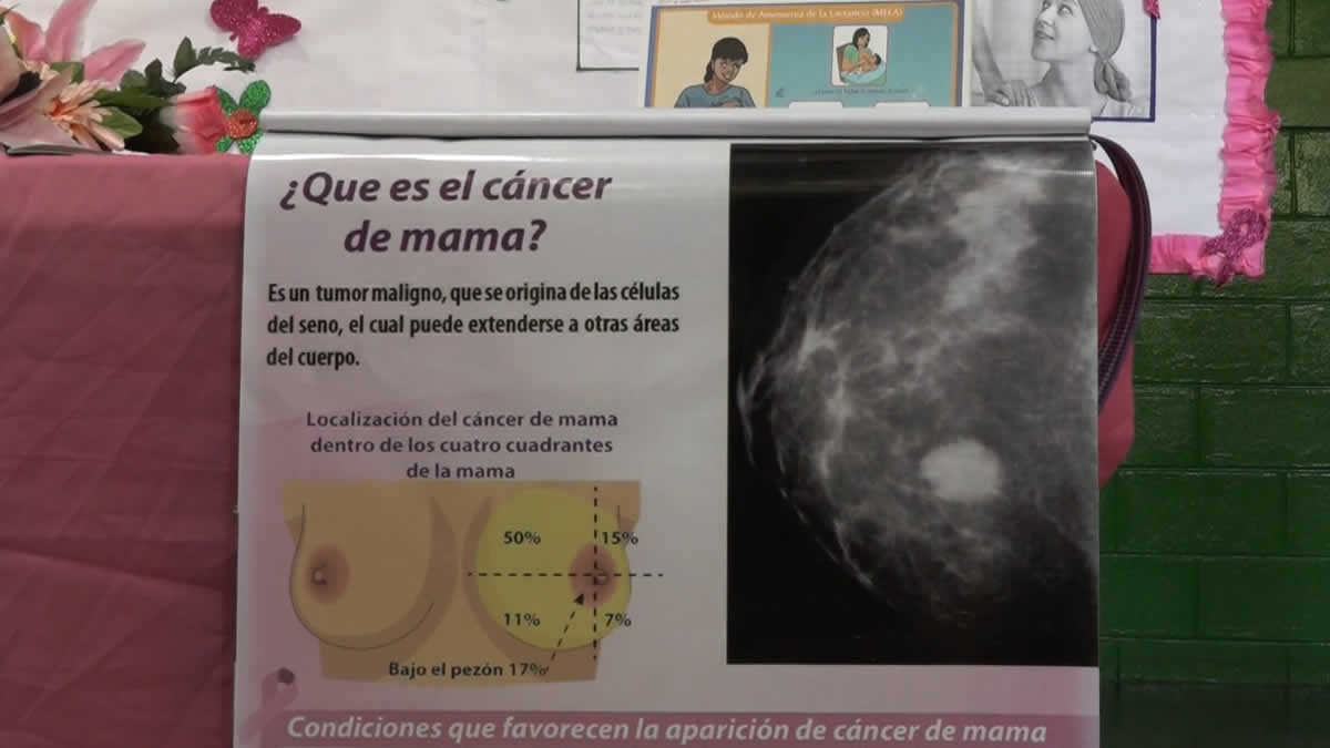 Realizan jornada de prevención contra el cáncer de mama en Altagracia