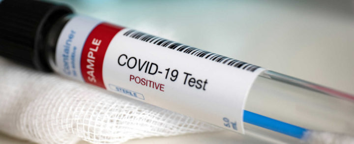 Más de 800 voluntarios se someten a pruebas de vacuna contra el COVID-19