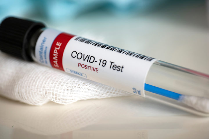 Más de 800 voluntarios se someten a pruebas de vacuna contra el COVID-19